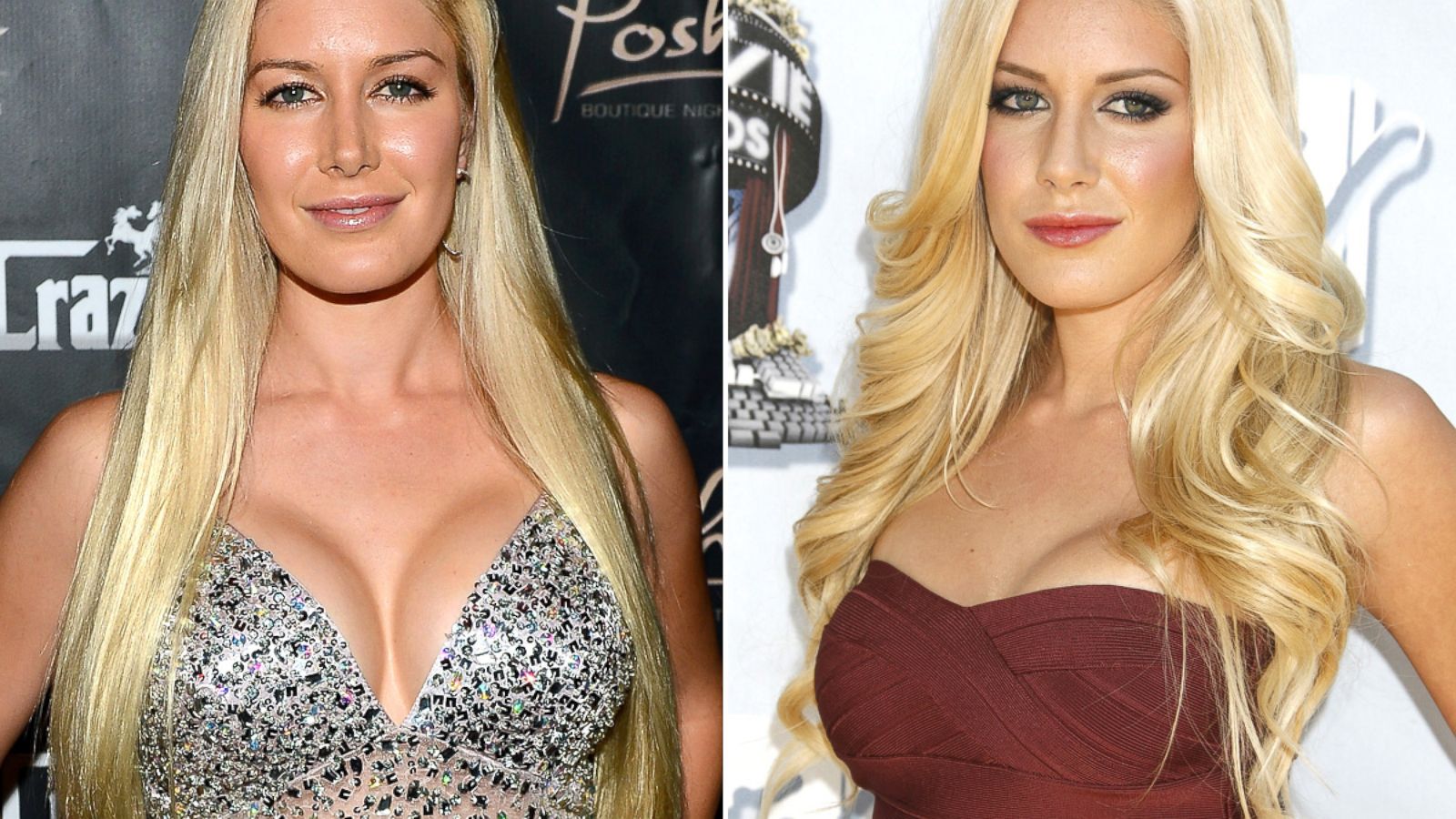 Celebrities Who Have Had Breast Reduction Surgery